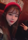 Nose, Eye, Fat Graft After 1 year!!! — Korea cost, reviews & before-after | MISOODA