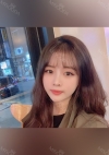 Nose, Eye, Fat Graft After 1 year!!! — Korea cost, reviews & before-after | MISOODA