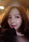 Double eyelids revision & Nose revision :) — Korea cost, reviews & before-after | MISOODA