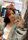 Double eyelids revision & Nose revision :) — Korea cost, reviews & before-after | MISOODA