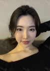 Facial Contour, Chin Reduction, Nose&Eye Surgery After 2 years — Korea cost, reviews & before-after | MISOODA