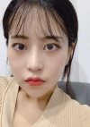 Facial Contour, Chin Reduction, Fat Graft ~!! — Korea cost, reviews & before-after | MISOODA