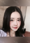 Facial Contour, Chin Reduction, Nose&Eye Surgery After 2 years — Korea cost, reviews & before-after | MISOODA
