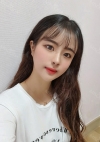 Nose, Eye, Fat Graft After 1 year!!! — Korea cost, reviews & before-after | MISOODA
