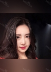 Facial Contour, Chin Reduction, Nose&Eye Surgery After 2 years — Korea cost, reviews & before-after | MISOODA
