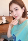 Double eyelids revision & Nose revision :) — Korea cost, reviews & before-after | MISOODA
