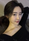 Facial Contour, Chin Reduction, Nose&Eye Surgery After 2 years — Korea cost, reviews & before-after | MISOODA
