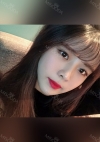 Nose, Eye, Fat Graft After 1 year!!! — Korea cost, reviews & before-after | MISOODA