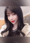 Facial Contour, Double Eyelid Surgery in TS PS!! — Korea cost, reviews & before-after | MISOODA