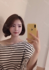Double eyelids revision & Nose revision :) — Korea cost, reviews & before-after | MISOODA