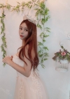 Facial Bone, Lateral canthoplasty — Korea cost, reviews & before-after | MISOODA