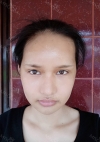 Facial bone, eye surgery, fat grafting — Korea cost, reviews & before-after | MISOODA