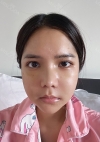 Facial Bone, Nose Surgery, Breast fat graft — Korea cost, reviews & before-after | MISOODA