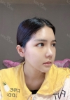 Facial Bone, Nose Surgery, Breast fat graft — Korea cost, reviews & before-after | MISOODA