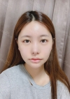 Facial Bone, Lateral canthoplasty — Korea cost, reviews & before-after | MISOODA