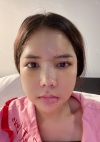Facial Bone, Nose Surgery, Breast fat graft — Korea cost, reviews & before-after | MISOODA
