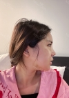Facial Bone, Nose Surgery, Breast fat graft — Korea cost, reviews & before-after | MISOODA