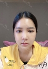 Facial Bone, Nose Surgery, Breast fat graft — Korea cost, reviews & before-after | MISOODA