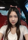 Facial Bone, Nose Surgery, Breast fat graft — Korea cost, reviews & before-after | MISOODA