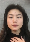 3 in 1 Facial Contouring — Korea cost, reviews & before-after | MISOODA
