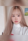 Eye Surgery (Epicanthoplasty + lateral canthoplasty) — Korea cost, reviews & before-after | MISOODA