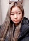 Eye Surgery (Epicanthoplasty + lateral canthoplasty) — Korea cost, reviews & before-after | MISOODA