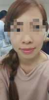 Aesthetic service, filler and toxin experience in Korea — Korea cost, reviews & before-after | MISOODA