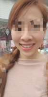 MISOODA — Korea cost, reviews & before-after | MISOODA