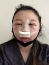 Girin: facial contouring, acculift, rhino, forehead lift, des, epi, fat graft — Korea cost, reviews & before-after | MISOODA