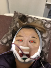 Girin: facial contouring, acculift, rhino, forehead lift, des, epi, fat graft — Korea cost, reviews & before-after | MISOODA