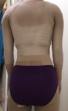 Liposuction and Breast Augmentation — Korea cost, reviews & before-after | MISOODA