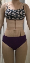 Liposuction and Breast Augmentation — Korea cost, reviews & before-after | MISOODA