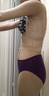 Liposuction and Breast Augmentation — Korea cost, reviews & before-after | MISOODA