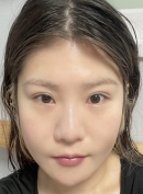 Misooda — Korea cost, reviews & before-after | MISOODA