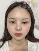 Misooda — Korea cost, reviews & before-after | MISOODA