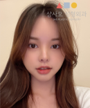 Misooda — Korea cost, reviews & before-after | MISOODA