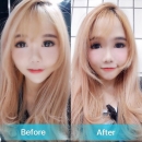 Misooda — Korea cost, reviews & before-after | MISOODA