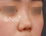 GNG Hospital, Reviews, Images, Promotions — Korea cost, reviews & before-after | MISOODA