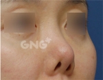 GNG Hospital, Reviews, Images, Promotions — Korea cost, reviews & before-after | MISOODA