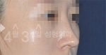 April 31 Plastic Surgery,Reviews,Images,Promotions — Korea cost, reviews & before-after | MISOODA