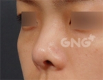 GNG Hospital, Reviews, Images, Promotions — Korea cost, reviews & before-after | MISOODA