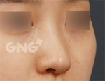 GNG Hospital, Reviews, Images, Promotions — Korea cost, reviews & before-after | MISOODA
