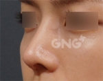 GNG Hospital, Reviews, Images, Promotions — Korea cost, reviews & before-after | MISOODA