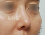 GNG Hospital, Reviews, Images, Promotions — Korea cost, reviews & before-after | MISOODA