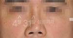 April 31 Plastic Surgery,Reviews,Images,Promotions — Korea cost, reviews & before-after | MISOODA