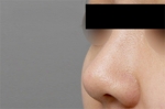 Mine Plastic Surgery, Reviews, Images, Promotions — Korea cost, reviews & before-after | MISOODA