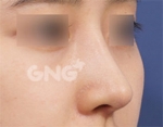 GNG Hospital, Reviews, Images, Promotions — Korea cost, reviews & before-after | MISOODA