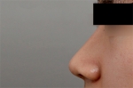 Mine Plastic Surgery, Reviews, Images, Promotions — Korea cost, reviews & before-after | MISOODA