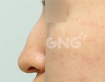 GNG Hospital, Reviews, Images, Promotions — Korea cost, reviews & before-after | MISOODA
