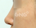 GNG Hospital, Reviews, Images, Promotions — Korea cost, reviews & before-after | MISOODA